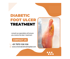 Diabetic Foot Ulcer Surgery in Coimbatore