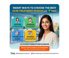 Smart ways to choose the best acne treatment in Delhi with Thio