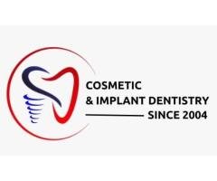 Dentacare - Best Dental Clinic in Bilekahalli