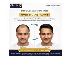 Expert Dermatologist in Bangalore for Healthy, Glowing Skin
