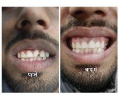 Tanwar Dental & Implant Clinic Hapur